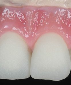 GC INITIAL LUSTRE PASTES NF