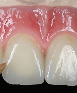 GC INITIAL LUSTRE PASTES NF