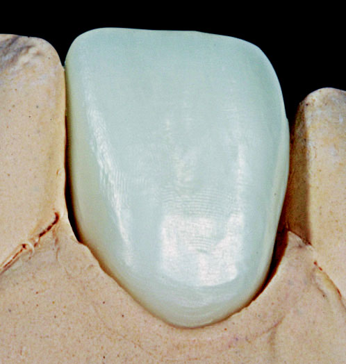 GC ZIRCONIA HIGHLIGHTS