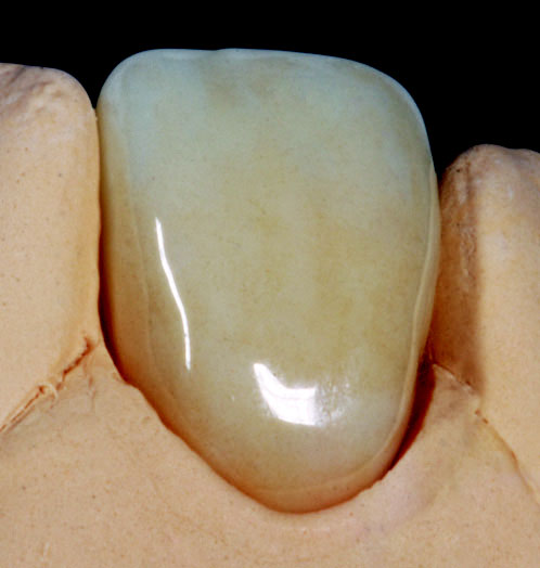 GC ZIRCONIA HIGHLIGHTS